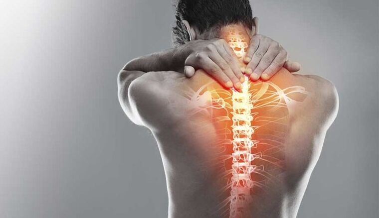 Silná bolesť v strede chrbta - príznak poškodenia chrbtice
