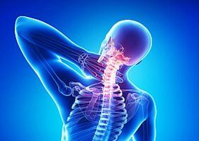 Osteochondróza - choroba chrbtice