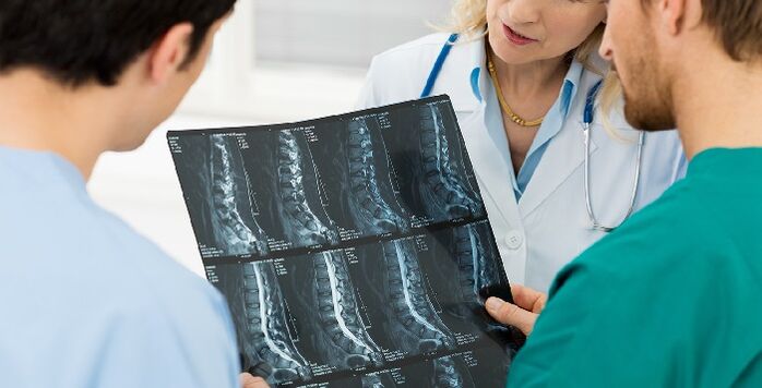 Röntgen chrbtice ako spôsob diagnostiky osteochondrózy
