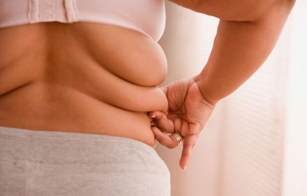 nadváha, príčina cervikálnej osteochondrózy u žien do 40 rokov